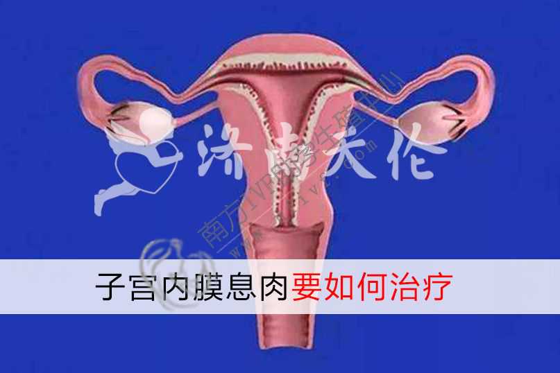 武汉代生孩子合法公司，健康 子宫内膜息肉要如何治疗?