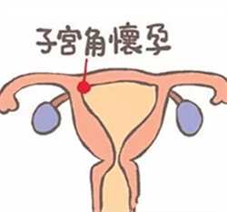 武汉哪里找代怀女，孕期骨盆检查注意事项